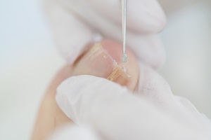 DSC2637CreditAdrianKuipersBehandeling